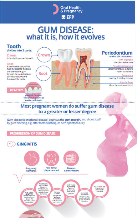 gum disease what it is how it evolves oral health and pregnancy