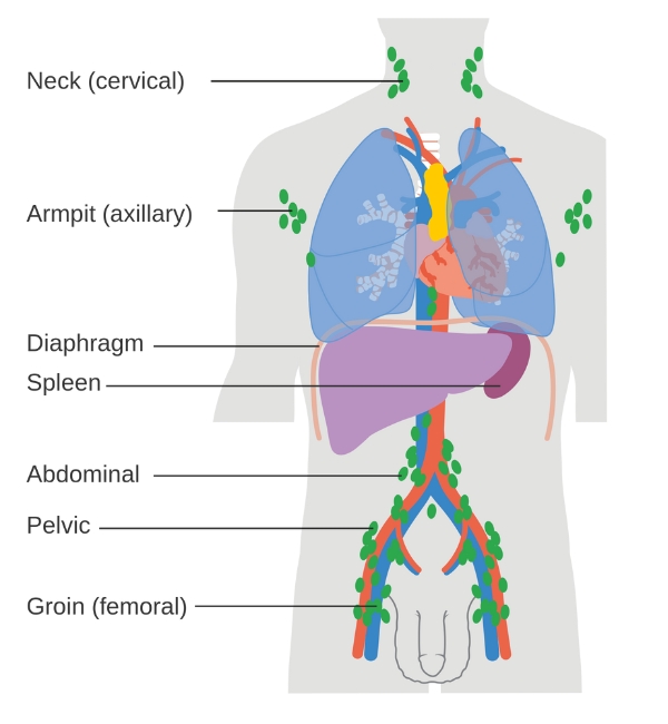 Locations of lymph nodes where lymphoma most commonly develops