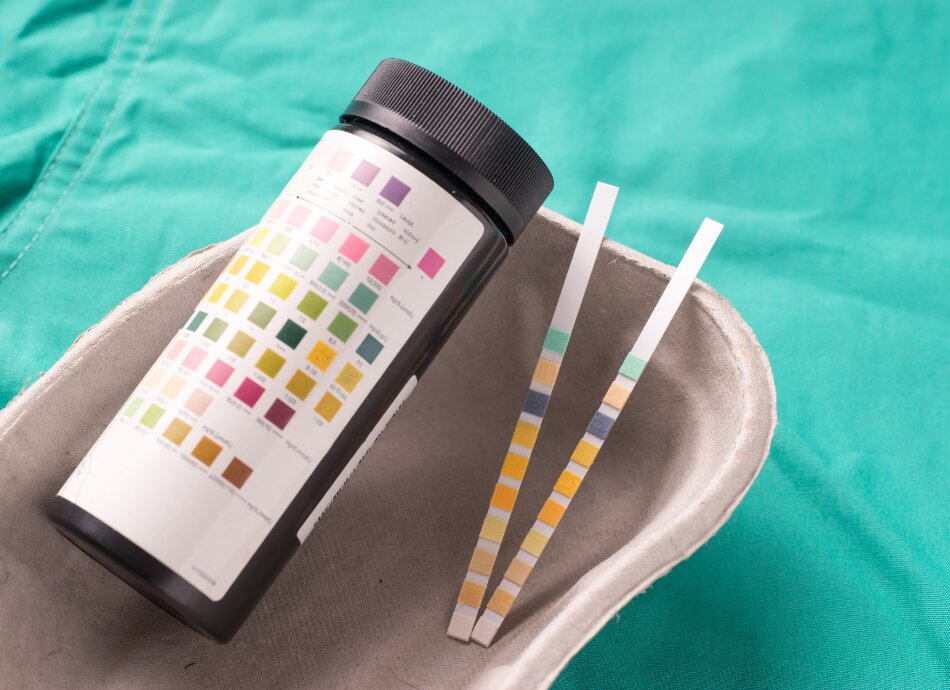 Urine dipsticks and container in a tray
