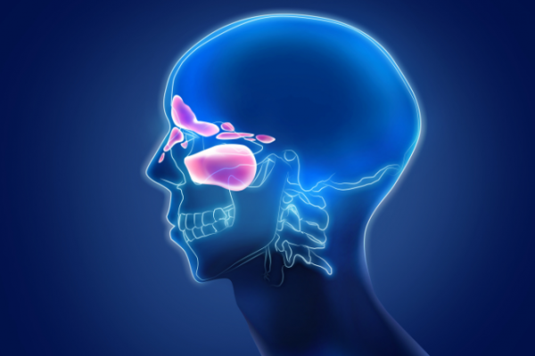 Graphic showing location of facial sinuses