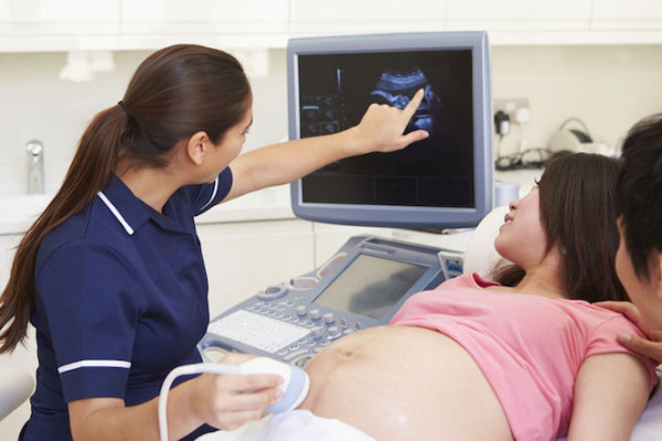 Technician showing baby on ultrasound to prospective parents