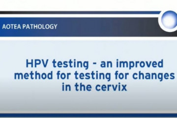 HPV testing and cervical screening