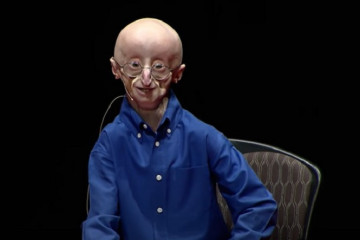 Progeria – a personal story