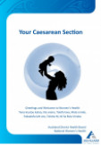 Your caesarean section
