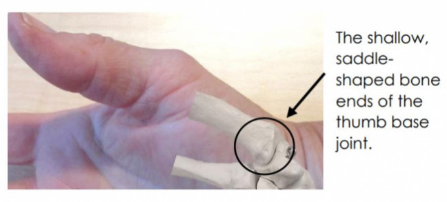 klient uendelig undersøgelse Basal thumb arthritis | Health Navigator NZ