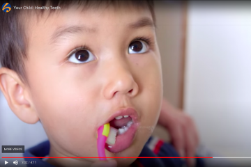 Dental health – children