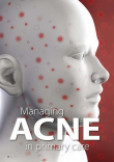 Managing acne in primary care