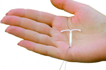Intrauterine devices (IUD) for contraception