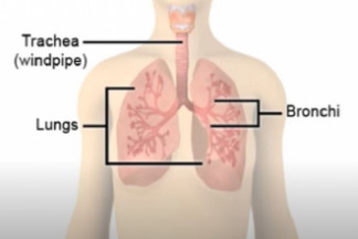 Pneumonia – explained
