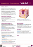 Basal cell carcinoma information sheet