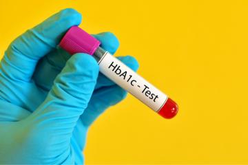 HbA1c test – diagnosing diabetes and pre-diabetes   