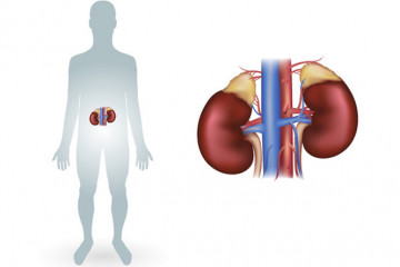Chronic kidney disease (CKD)