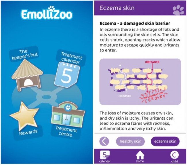 Emollizoo eczema app screenshots