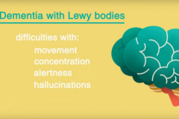 Dementia – lewy bodies