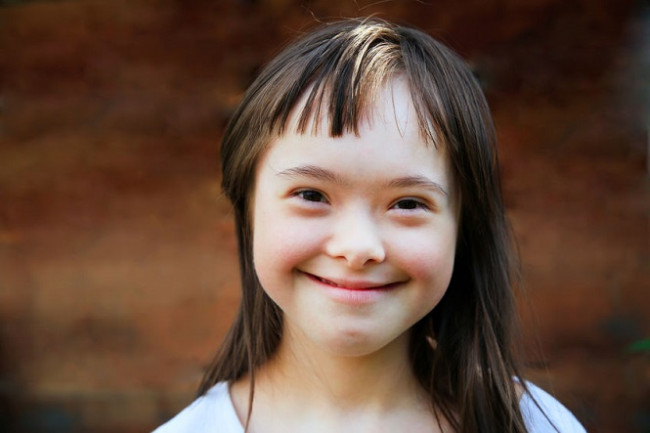 Down syndrome | Health Navigator NZ